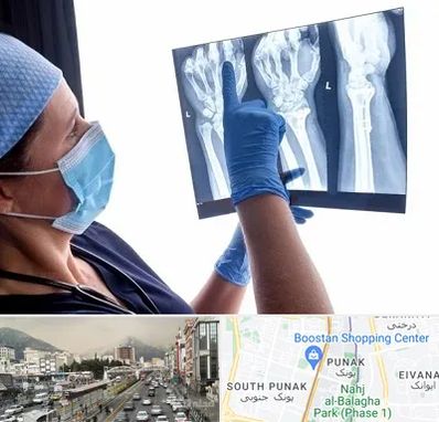 تجهیزات ارتوپدی در پونک 