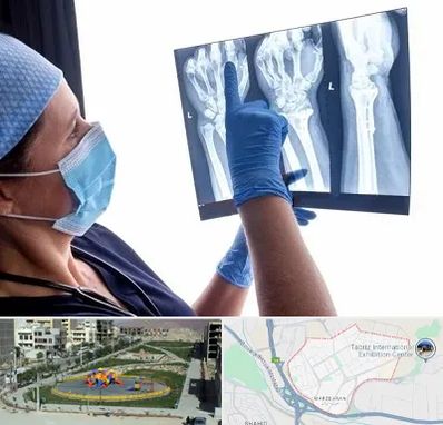 تجهیزات ارتوپدی در مرزداران تبریز