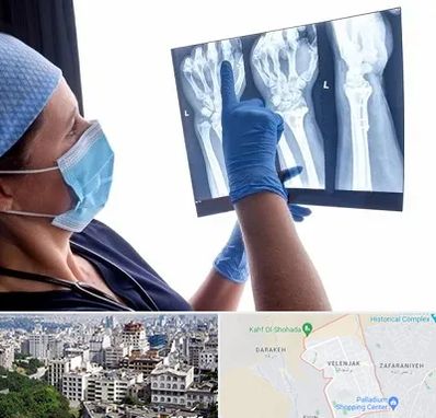 تجهیزات ارتوپدی در ولنجک 