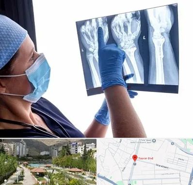 تجهیزات ارتوپدی در بلوار تعاون