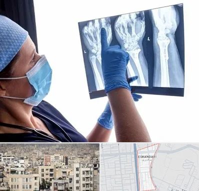 تجهیزات ارتوپدی در اسکندری