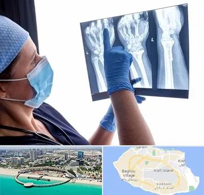 تجهیزات ارتوپدی در کیش