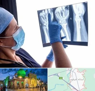 تجهیزات ارتوپدی در آستانه اشرفیه