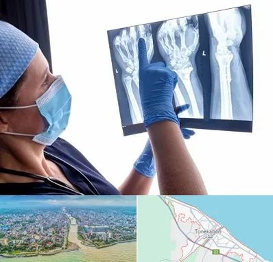 تجهیزات ارتوپدی در تنکابن