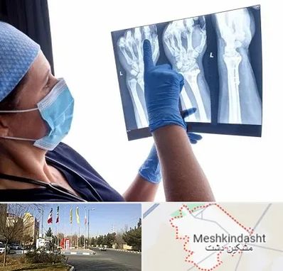 تجهیزات ارتوپدی در مشکین دشت