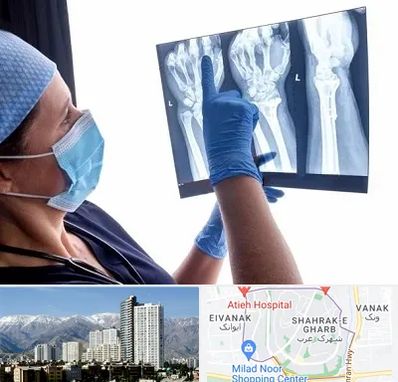 تجهیزات ارتوپدی در شهرک غرب 