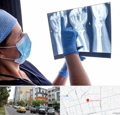 تجهیزات ارتوپدی در هفده شهریور تبریز