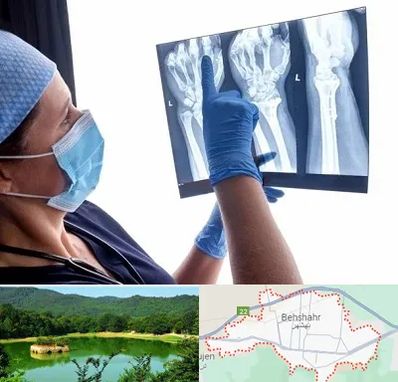 تجهیزات ارتوپدی در بهشهر