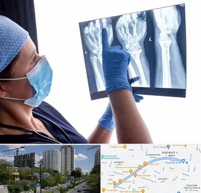 تجهیزات ارتوپدی در اندرزگو