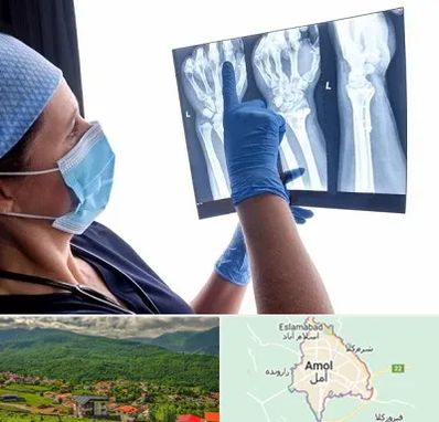 تجهیزات ارتوپدی در آمل