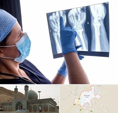 تجهیزات ارتوپدی در شهرضا