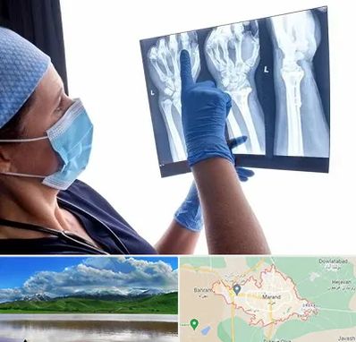 تجهیزات ارتوپدی در مرند