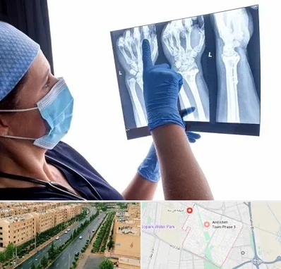 تجهیزات ارتوپدی در فاز سه اندیشه