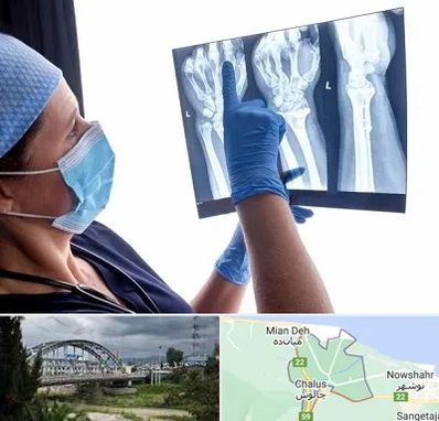 تجهیزات ارتوپدی در چالوس