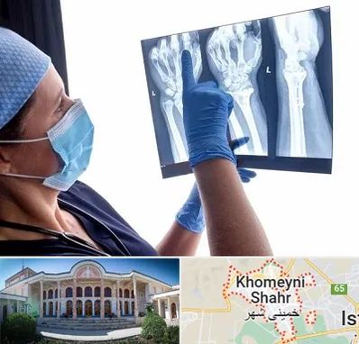 تجهیزات ارتوپدی در خمینی شهر