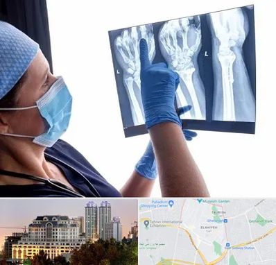 تجهیزات ارتوپدی در فرشته 