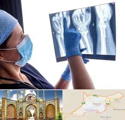 تجهیزات ارتوپدی در سمنان