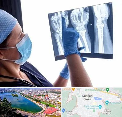 تجهیزات ارتوپدی در لاهیجان