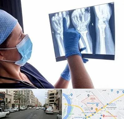 تجهیزات ارتوپدی در زیتون کارمندی اهواز