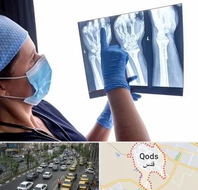 تجهیزات ارتوپدی در شهر قدس
