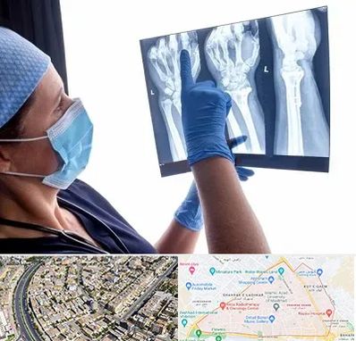 تجهیزات ارتوپدی در شهرک غرب مشهد