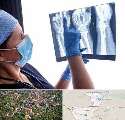 تجهیزات ارتوپدی در دماوند