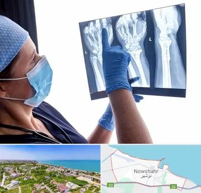تجهیزات ارتوپدی در نوشهر