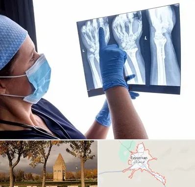 تجهیزات ارتوپدی در تویسرکان