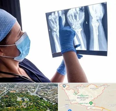تجهیزات ارتوپدی در شهرکرد