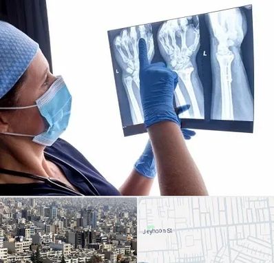 تجهیزات ارتوپدی در جیحون