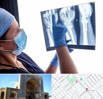 تجهیزات ارتوپدی در مصلی مشهد