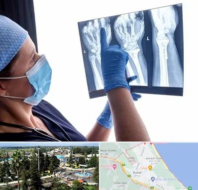 تجهیزات ارتوپدی در رودسر