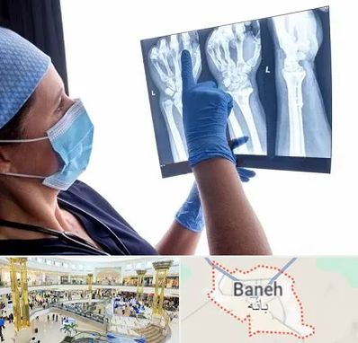 تجهیزات ارتوپدی در بانه