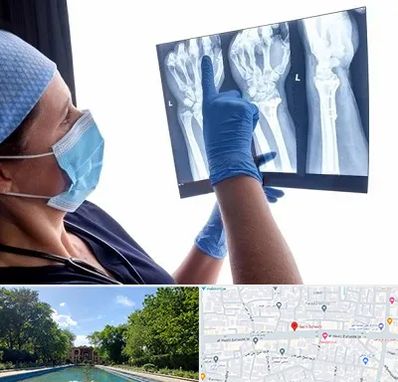 تجهیزات ارتوپدی در هشت بهشت اصفهان