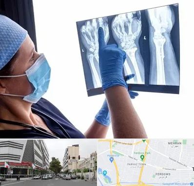 تجهیزات ارتوپدی در بلوار فردوس 