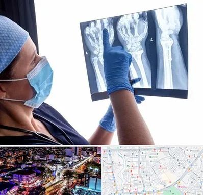 تجهیزات ارتوپدی در منظریه رشت