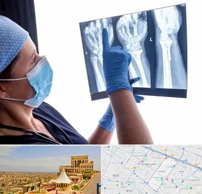 تجهیزات ارتوپدی در هاشمیه مشهد