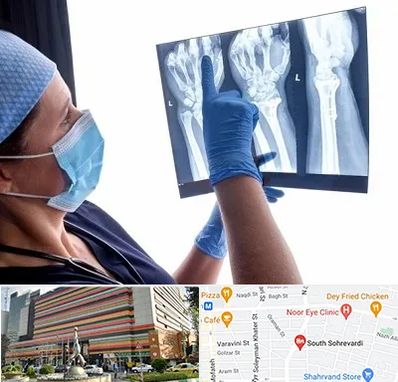 تجهیزات ارتوپدی در سهروردی 