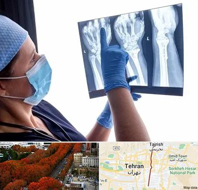 تجهیزات ارتوپدی در ولیعصر 