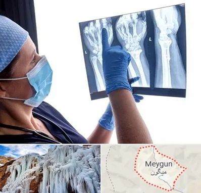 تجهیزات ارتوپدی در میگون