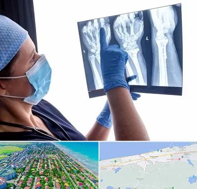 تجهیزات ارتوپدی در فریدونکنار