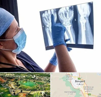 تجهیزات ارتوپدی در بروجرد