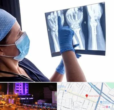 تجهیزات ارتوپدی در آبرسان تبریز