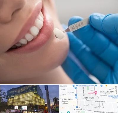 مرکز لمینت دندان در جمهوری