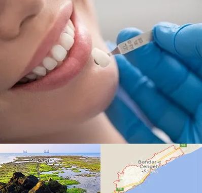 مرکز لمینت دندان در بندرلنگه