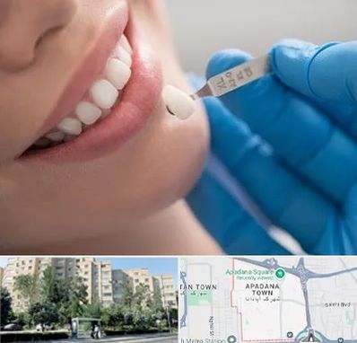 مرکز لمینت دندان در آپادانا