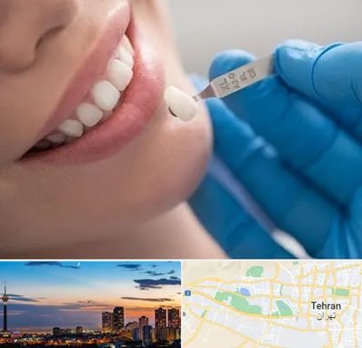 مرکز لمینت دندان در غرب تهران