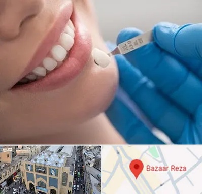 مرکز لمینت دندان در بازار رضا مشهد