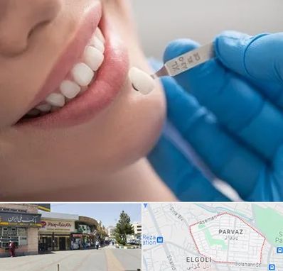 مرکز لمینت دندان در پرواز تبریز