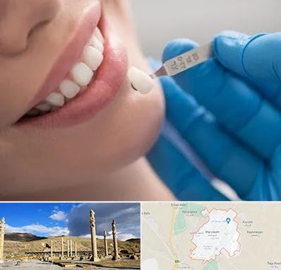 مرکز لمینت دندان در مرودشت